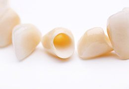 Tooth-colored dental crowns