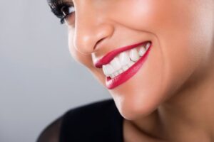 Close-up of woman’s bright white smile 